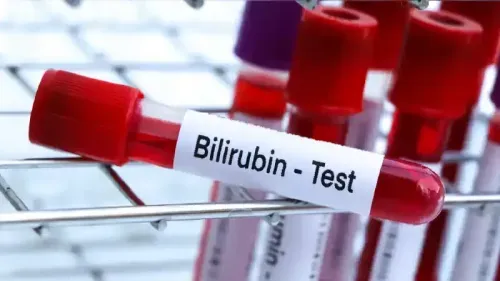 What is a Dangerous Level of Bilirubin in Adults?